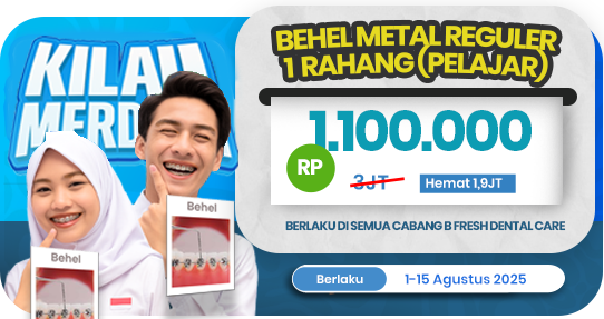 Behel Metal Reguler 1 rahang (Khusus Pelajar)